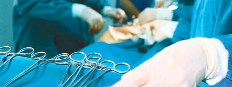 Operation zur Penisvergrößerung durch einen Chirurgen